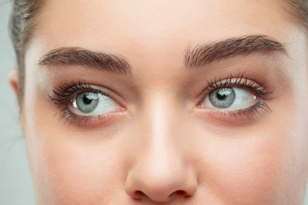 Lower Blepharoplasty vs. Tear Trough Filler