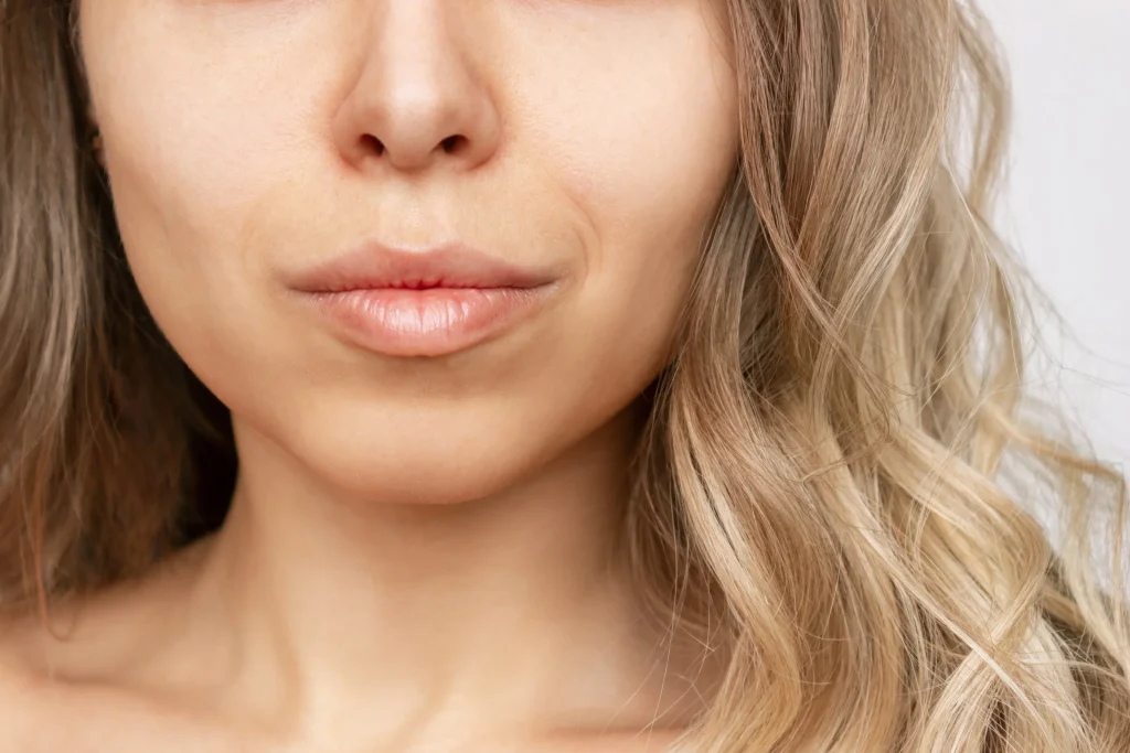 Who is a Candidate for Buccal Fat Removal?